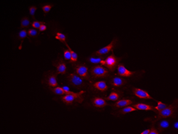 Moc2 Radiotherapy MOC2 Mouse Oral Squamous Cell Carcinoma (OSCC) Cell Line | SCC470